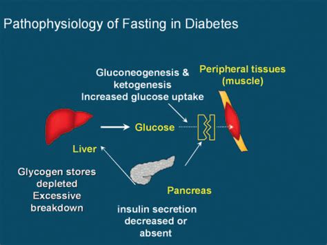 Fasting in diabetes